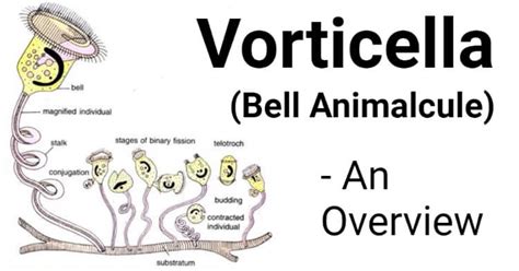  Bell Animalcule: De schitterende wereld van de bacterievreters en hun fascinerende dansbewegingen!