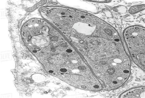  Neospora! Een Microscopicke Reus die Ons Leven Op een Onverwachte Manier Beïnvloedt